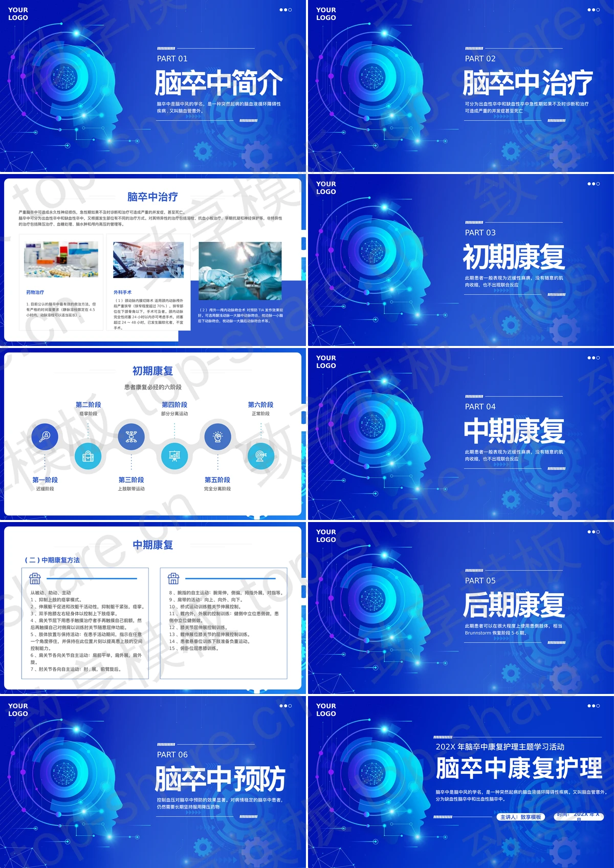 图片[2]-蓝色科技风脑卒中康复护理主题学习活动PPT模板 - 致享TOP-SHARE-致享TOP-SHARE
